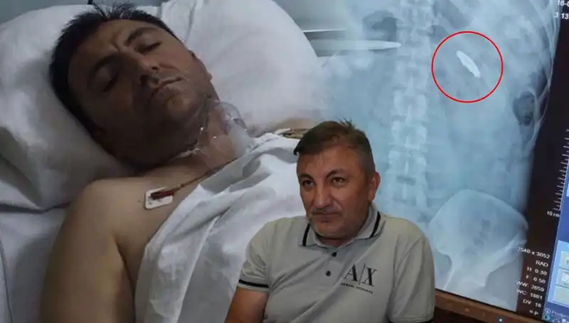 15 Temmuz Gecesi: Vücudunda Kurşunla Taşıdığı Acı Miras