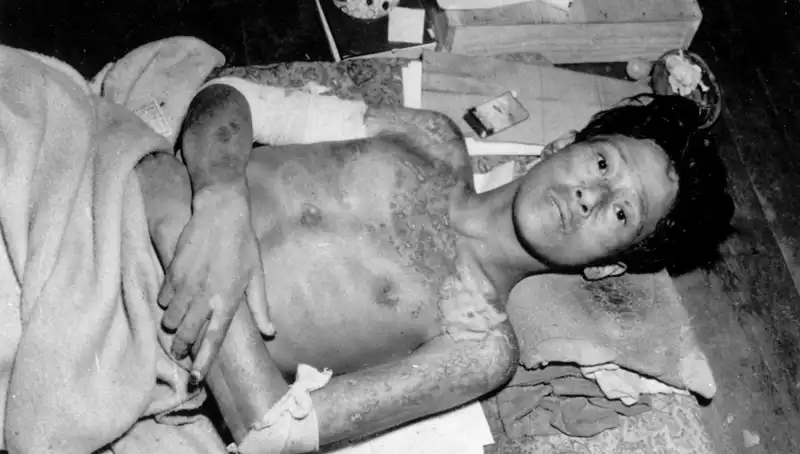 Nagasaki'nin 80 Yıl Sonra Gelen Çığlığı: Nükleer Felaket Uyarısı